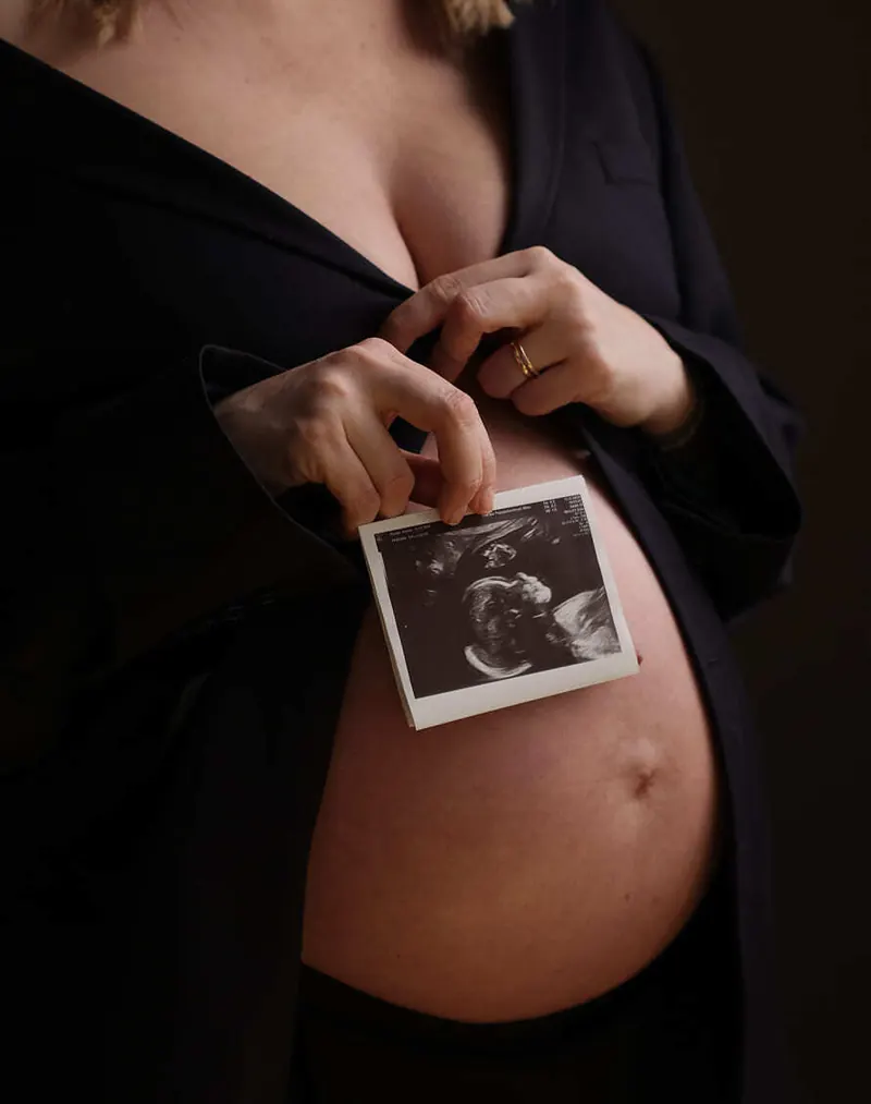 Babybauch Fotoshooting. Fotostudio Ausstellungsstraße